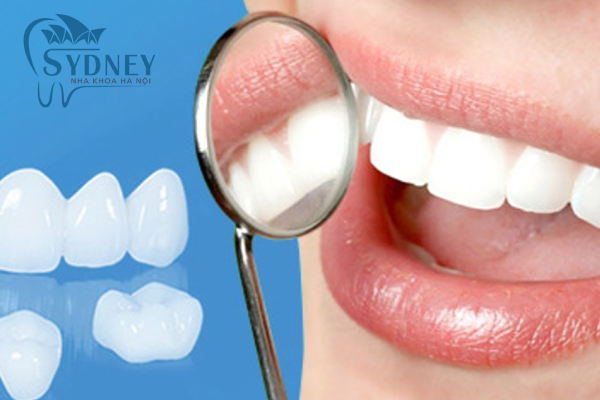 Răng sứ thẩm mỹ giúp bạn khắc phục được nhiều vấn đề về răng hơn