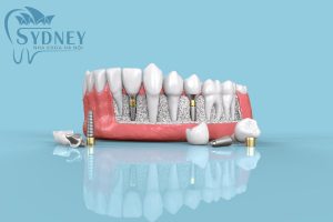 Phác đồ điều trị.