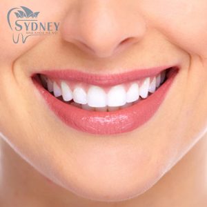 Những phương pháp trồng răng của hiệu quả tại nha khoa sydney?