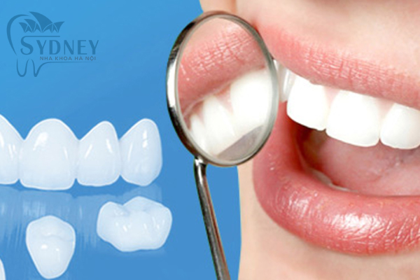 Lớp răng sứ như một lớp áo cho răng trắng sáng hơn
