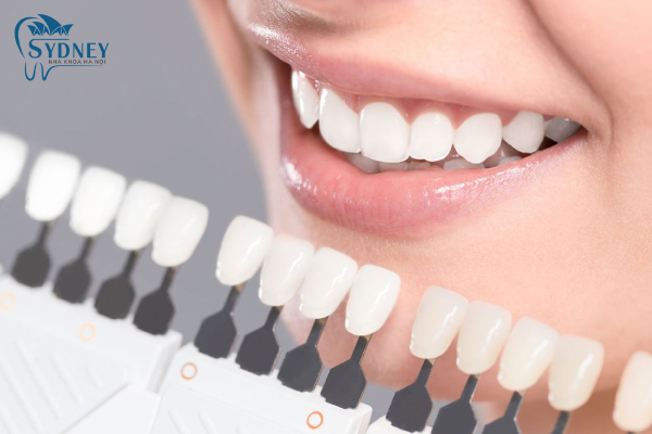 Răng sứ thẩm mỹ có rất nhiều loại