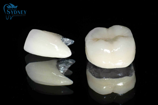 Bọc răng sứ liệu có tốt không?