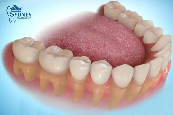 Phương pháp này có rất nhiều ưu điểm