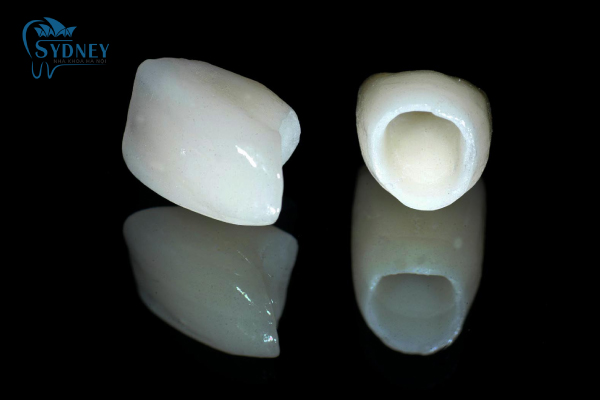 Hãy sử dụng dịch vụ của nha khoa Sydney chúng tôi