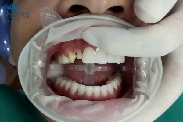 Đội ngũ bác sĩ chuyên gia có tay nghề