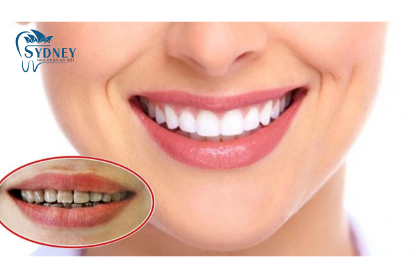 Có 3 tiêu trí để lựa chọn địa chỉ làm răng