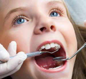 Khuôn mặt có thể bị biến dạng