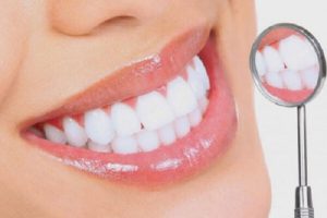 phương pháp bọc răng sứ