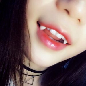Phương pháp trồng răng khểnh