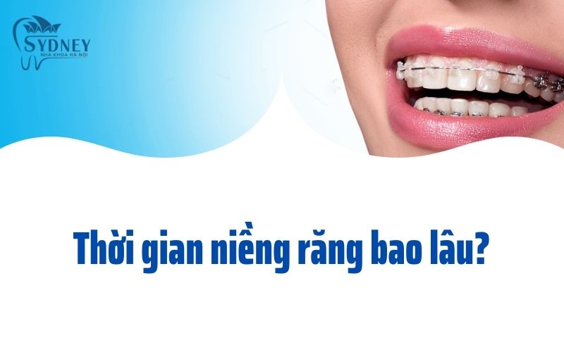 Thời gian niềng răng bao lâu?